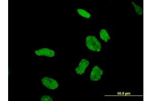 Immunofluorescence of monoclonal antibody to DDX11 on HeLa cell.
