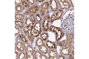 Immunohistochemical staining of human kidney with KCTD14 polyclonal antibody  shows strong cytoplasmic positivity in cells in tubules.
