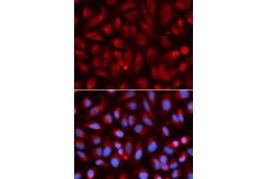 Immunofluorescence analysis of U2OS cells using ADA antibody. (ADA antibody)