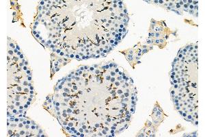 ABIN6266305 and ABIN6277424 at 1/100 staining Mouse testis tissue by IHC-P. (PDK4 antibody  (C-Term))