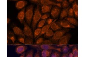 Immunofluorescence analysis of HeLa cells using IPO4 Polyclonal Antibody at dilution of 1:100. (Importin 4 antibody)