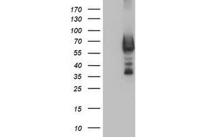 Western Blotting (WB) image for anti-Dystrobrevin, beta (DTNB) antibody (ABIN1497916) (Dystrobrevin beta antibody)
