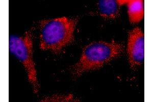 Immunofluorescence (IF) image for anti-Integrin-Linked Kinase (ILK) (AA 402-451) antibody (ABIN7448388)