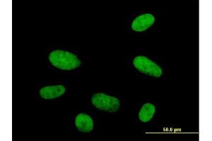 Immunofluorescence of  purified  MaxPab antibody to HMG20A on HepG2 cell. (HMG20A antibody  (AA 1-347))