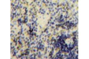 Immunohistochemistry (IHC) image for anti-B-Cell Linker (BLNK) (AA 65-314) antibody (ABIN7441781)