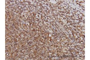 Immunoperoxidase of monoclonal antibody to PTGIR on formalin-fixed paraffin-embedded human tonsil. (Prostacyclin Receptor antibody  (AA 296-386))