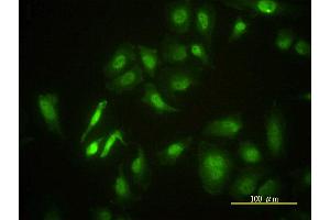 Immunofluorescence of monoclonal antibody to STK4 on HeLa cell. (STK4 antibody  (AA 1-39))