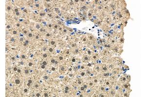 ABIN6263495 and ABIN6278938 at 1/100 staining Mouse liver tissue by IHC-P.