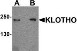 Western blot analysis of KLOTHO in rat heart tissue lysate with KLOTHO antibody at (A) 1 and (B) 2 μg/ml. (Klotho antibody  (Center))