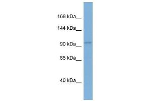 EIF2C1 antibody used at 1 ug/ml to detect target protein. (AGO1 antibody  (N-Term))