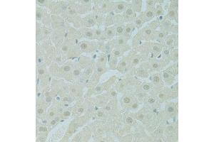 Immunohistochemistry of paraffin-embedded rat liver using PHOX2B antibody (ABIN5995873) at dilution of 1/100 (40x lens). (PHOX2B antibody)