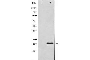 Western blot analysis of Survivin expression in Mouse lungtissue lysates,The lane on the left is treated with the antigen-specific peptide. (Survivin antibody  (Internal Region))