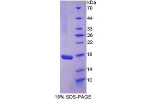 SDS-PAGE (SDS) image for Interleukin 17 (IL17) (AA 21-153) protein (His tag) (ABIN1525474) (IL-17 Protein (AA 21-153) (His tag))
