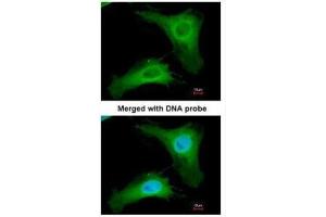 ICC/IF Image Immunofluorescence analysis of paraformaldehyde-fixed HeLa, using PHLP, antibody at 1:200 dilution. (Phosducin-Like antibody)