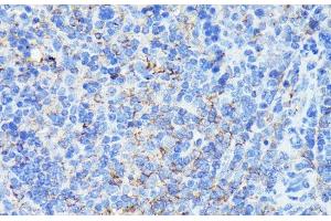 Immunohistochemistry of paraffin-embedded Mouse spleen using MADCAM1 Polyclonal Antibody at dilution of 1:100 (40x lens).