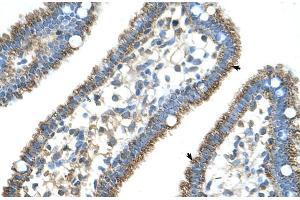 Human Intestine (CPS1 antibody  (N-Term))