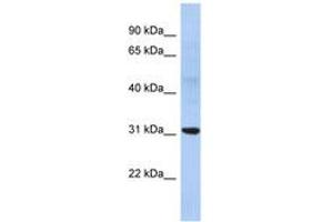 Image no. 1 for anti-Nucleoside Phosphorylase (NP) (AA 107-156) antibody (ABIN6743475) (PNP antibody  (AA 107-156))