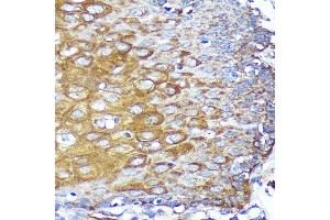 Immunohistochemistry of paraffin-embedded Human esophageal using CYB5R1 Rabbit pAb (ABIN7266630) at dilution of 1:100 (40x lens). (CYB5R1 antibody  (AA 1-305))