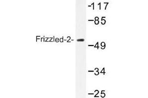 Image no. 1 for anti-Frizzled Family Receptor 2 (FZD2) antibody (ABIN317860) (FZD2 antibody)
