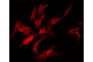 ABIN6274348 staining HuvEc by IF/ICC. (TNFAIP1 antibody  (Internal Region))