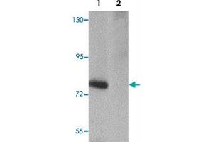 Western blot analysis of SESTD1 in rat brain tissue lysate with SESTD1 polyclonal antibody  at 1 ug/mL in (1) the absence and (2) the presence of blocking peptide. (SESTD1 antibody  (C-Term))