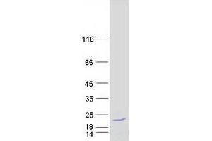 Validation with Western Blot (KIAA0101 Protein (Transcript Variant 1) (Myc-DYKDDDDK Tag))