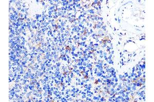 Immunohistochemistry (IHC) image for anti-CD40 Ligand (CD40LG) (AA 79-129) antibody (ABIN6138190)