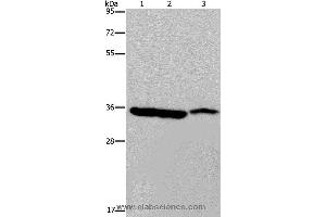 Western blot analysis of Mouse heart, liver and stomach tissue, using MDH1 Polyclonal Antibody at dilution of 1:500