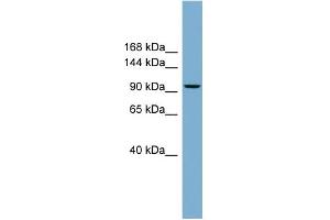 WB Suggested Anti-PPP1R3A Antibody Titration:  0. (PPP1R3A antibody  (N-Term))