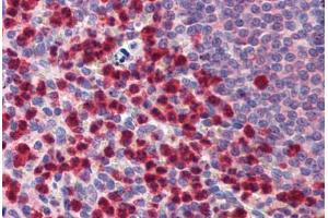 Immunohistochemistry (Formalin-fixed Paraffin-embedded Sections) (IHC (fp)) image for anti-Caspase 9, Apoptosis-Related Cysteine Peptidase (CASP9) (AA 299-318) antibody (ABIN462427)