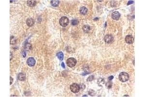Immunohistochemistry of Il1rl1 in mouse kidney tissue with Il1rl1 polyclonal antibody  at 2 ug/mL . (IL1RL1 antibody  (N-Term))