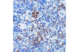 Immunohistochemistry of paraffin-embedded mouse spleen using BTK Rabbit mAb (ABIN7265950) at dilution of 1:100 (40x lens). (BTK antibody)