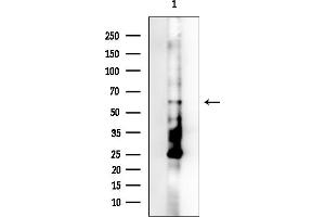 Western blot analysis of lysates from EC304 cells(UV treatment), using WIPF1 Antibody.