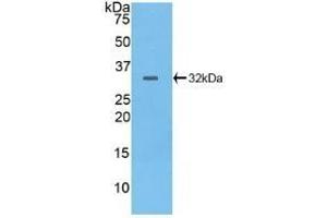 Detection of Recombinant PTPRB, Human using Polyclonal Antibody to Protein Tyrosine Phosphatase Receptor Type B (PTPRB) (PTPRB antibody  (AA 1655-1918))