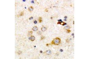 Immunohistochemical analysis of Clusterin staining in human brain formalin fixed paraffin embedded tissue section. (Clusterin antibody)