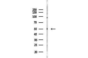 anti-Major Histocompatibility Complex, Class II, DP beta 1 (HLA-DPB1) (Internal Region) antibody