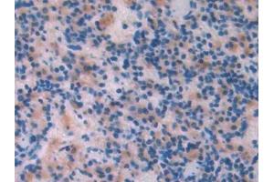 Detection of LCAT in Rat Spleen Tissue using Polyclonal Antibody to Lecithin Cholesterol Acyltransferase (LCAT) (LCAT antibody  (AA 41-210))