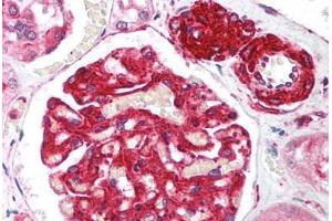Human Kidney (formalin-fixed, paraffin-embedded) stained with RIF1 antibody ABIN214034 at 5 ug/ml followed by biotinylated goat anti-rabbit IgG secondary antibody ABIN481713, alkaline phosphatase-streptavidin and chromogen. (RIF1 antibody  (AA 2406-2419))