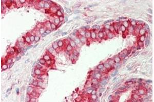 Human Prostate: Formalin-Fixed, Paraffin-Embedded (FFPE) (PDIA4 antibody  (AA 9-37))
