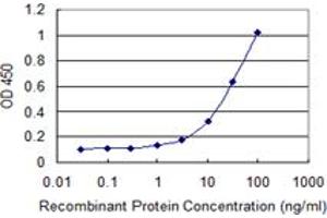 Detection limit for recombinant GST tagged EDC4 is 0. (EDC4 antibody  (AA 1302-1401))