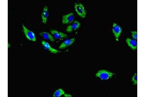 Immunofluorescent analysis of A549 cells using ABIN7142053 at dilution of 1:100 and Alexa Fluor 488-congugated AffiniPure Goat Anti-Rabbit IgG(H+L) (PLCD4 antibody  (AA 1-290))