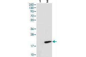 Western blot analysis of Lane 1: Negative control (vector only transfected HEK293T lysate), Lane 2: Over-expression Lysate (Co-expressed with a C-terminal myc-DDK tag (~3. (RNF7 antibody)