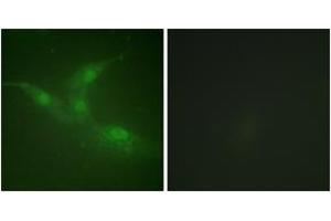 Immunofluorescence analysis of NIH-3T3 cells, using Breast Tumor Kinase (Phospho-Tyr447) Antibody. (PTK6 antibody  (pTyr447))