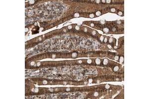 Immunohistochemical staining of human duodenum with SPAG7 polyclonal antibody  shows strong positivity in glandular cells. (SPAG7 antibody)