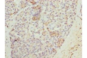 Immunohistochemistry of paraffin-embedded human pancreatic tissue using ABIN7161122 at dilution of 1:100 (N4BP2L2 antibody  (AA 1-300))