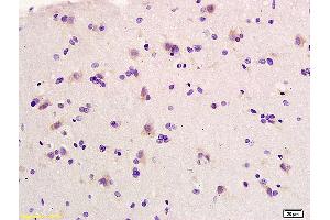 Immunohistochemistry (IHC) image for anti-Elastin (ELN) (AA 681-786) antibody (ABIN734003)