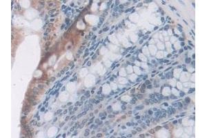 Immunohistochemistry (IHC) image for anti-Leptin Receptor (LEPR) (AA 22-203) antibody (ABIN7430876)