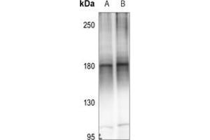 Western blot analysis of MEKK4 expression in A549 (A), EC9706 (B) whole cell lysates.