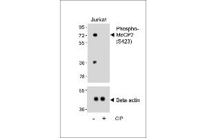 Western blot analysis of lysates from Jurkat cell line, untreated or treated with calf intestinal alkaline phosphatase(CIP), using Phospho-MeCP2 Antibody (upper) or Beta-actin (lower). (MECP2 antibody  (pSer423))