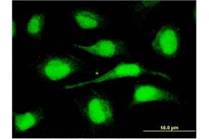 Immunofluorescence of monoclonal antibody to ORC6L on HeLa cell. (ORC6 antibody  (AA 1-252))